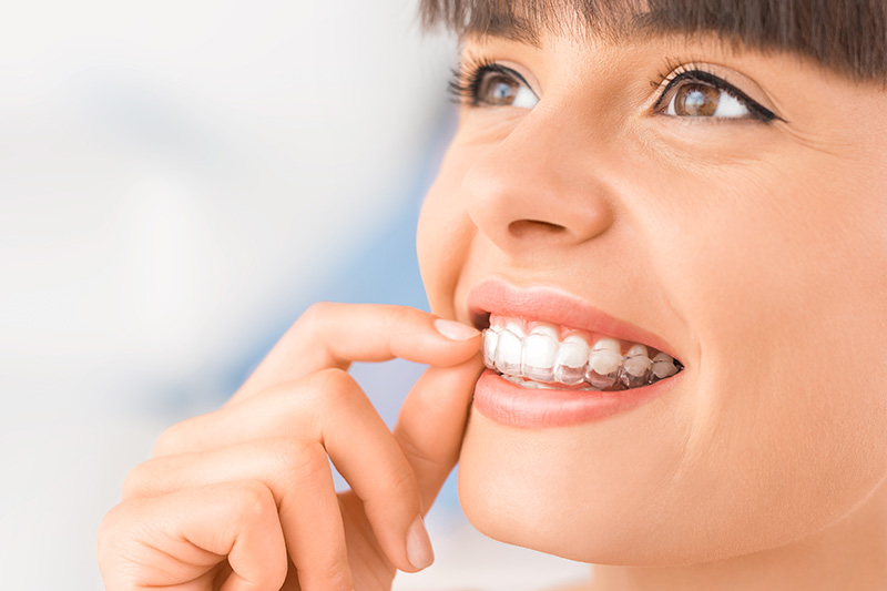 Orthodontics in Aliso Viejo